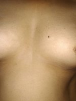 Samatha
