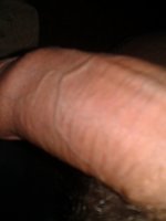 Yazva1