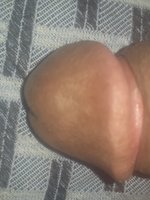 cvs123