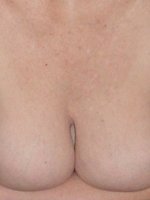 anonymous2